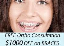Free Ortho Consultation $1000 Off on braces Missouri city TX